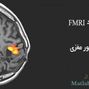 بررسی کاربرد FMRI در تشخیص تومور مغزی