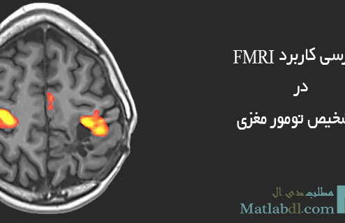 بررسی کاربرد FMRI در تشخیص تومور مغزی