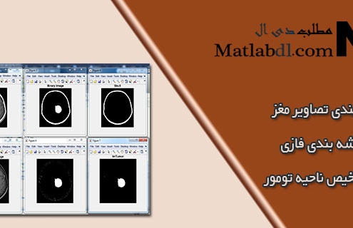 قطعه بندی تصاویر MRI مغز با خوشه بندی فازی برای تشخیص ناحیه تومور